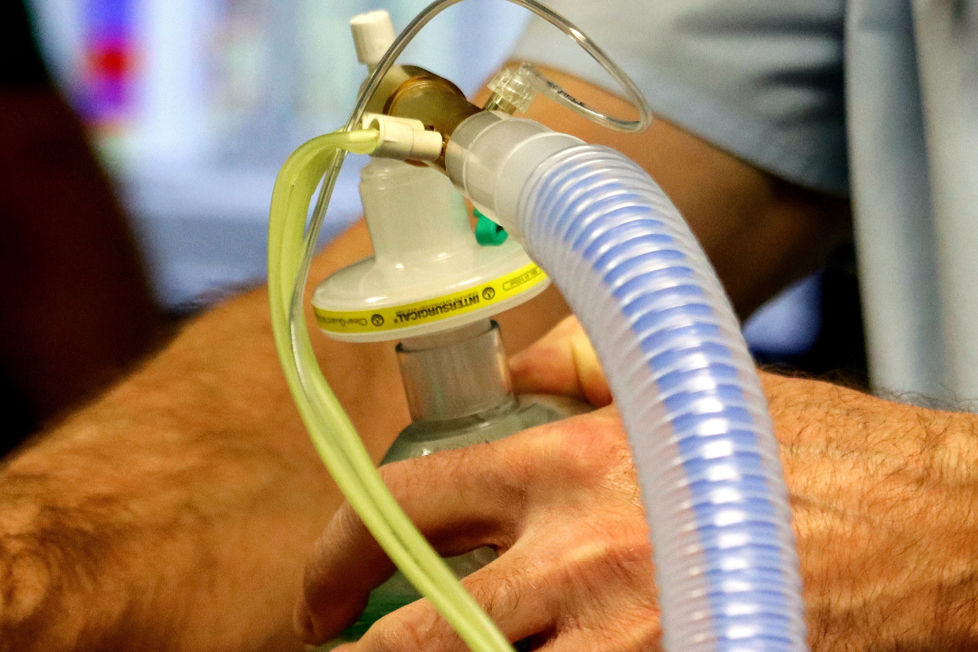 Making the Right Connection Benefits of Genderless Aseptic Connectors